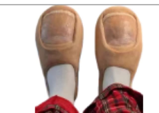 Feet Slides